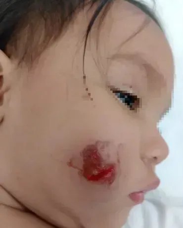 Una patota atacó una casa en Goya e hirió a una bebé