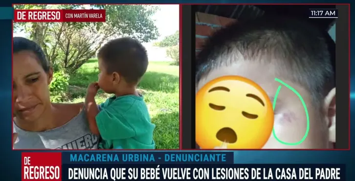 Corrientes: una madre denuncia que su bebé vuelve con lesiones de la casa del padre y la justicia no