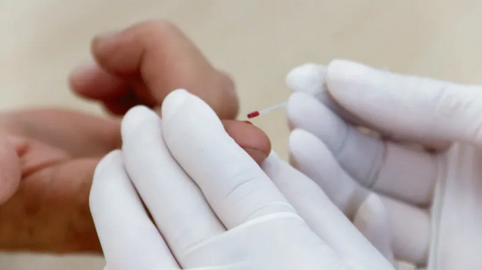 El NEA, una de las regiones con mayores casos de sífilis durante 2025