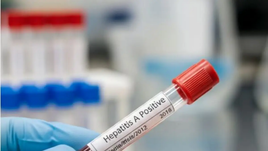 Crecen los casos de hepatitis A en el país y encontraron otro virus poco conocido
