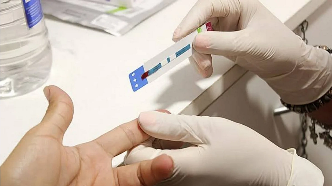 Advierten un aumento de VIH y Sífilis en jóvenes de entre 19 y 35 años en Corrientes