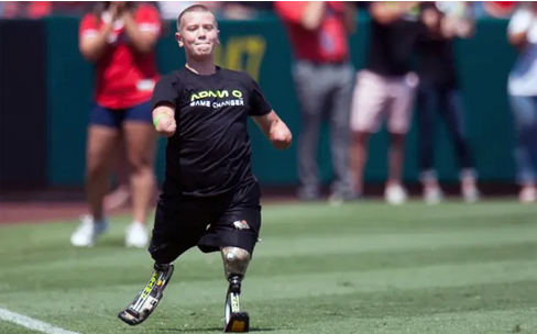 Acusan a un deportista sin manos ni piernas de matar a tiros a un hombre